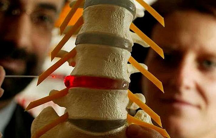 Changes in the integrity of intervertebral disks