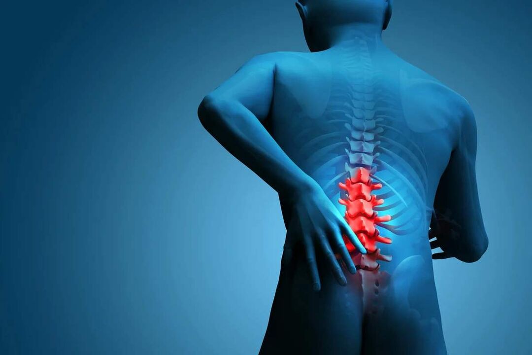 The main symptom of lumbar spine osteochondrosis is pain in the lower back. 