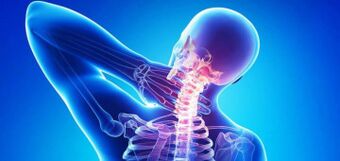 Cervical osteochondrose causes