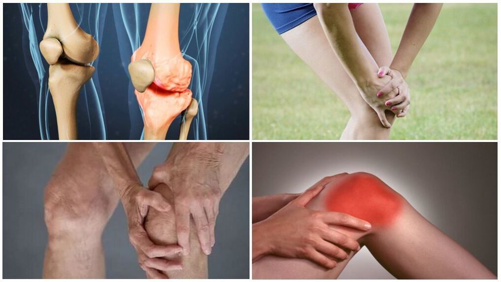 Phases of arthrosis