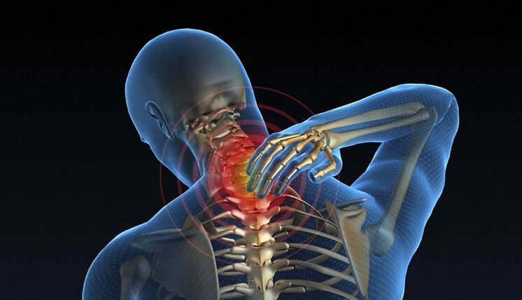 pinched nerve in the spine as a cause of lower back pain